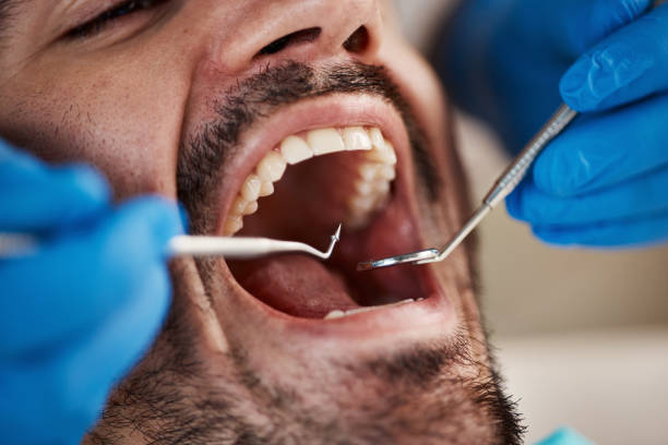 Best Emergency Dental Services Near Me  in Cassville, WV